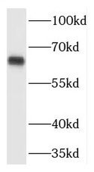 TPTE Rabbit Polyclonal Antibody