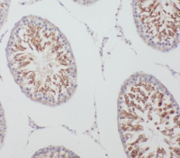 TPTE Rabbit Polyclonal Antibody