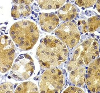 TRAF3 Rabbit Polyclonal Antibody