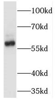 TRAF6 Rabbit Polyclonal Antibody