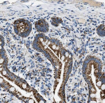 TRAF6 Rabbit Polyclonal Antibody