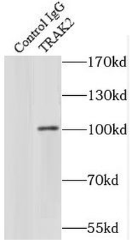 TRAK2 Rabbit Polyclonal Antibody