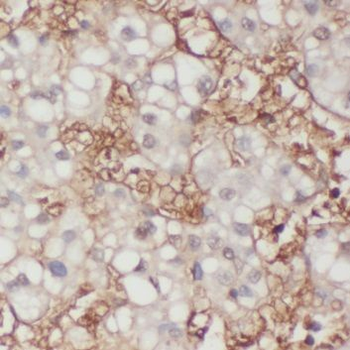 TRAK2 Rabbit Polyclonal Antibody