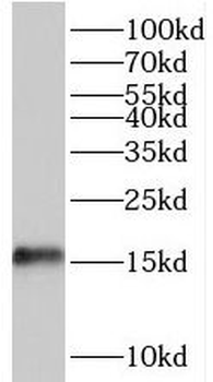 TRAPPC2L Rabbit Polyclonal Antibody