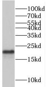 TRAPPC3 Antibody