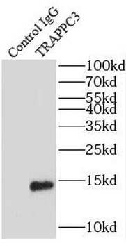 TRAPPC3 Rabbit Polyclonal Antibody