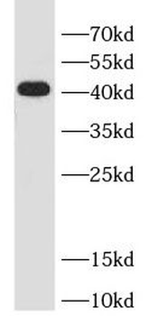 TARBP2 Antibody