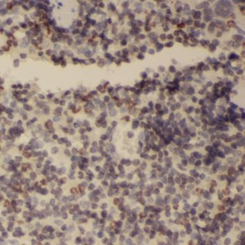 TREML4 Rabbit Polyclonal Antibody