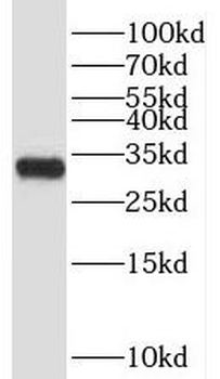 TRIAP1 Antibody