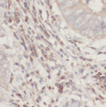 TRIM31 Rabbit Polyclonal Antibody