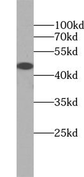 TRIM39 Antibody