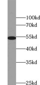 TRIM44 Antibody