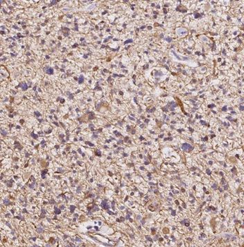 TRIM44 Rabbit Polyclonal Antibody
