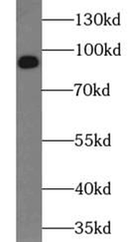 NTRK2 Antibody