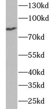 TRMT1 Antibody