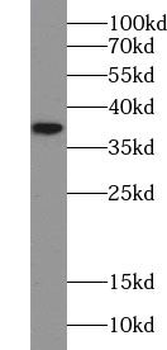 TRNAU1AP Antibody