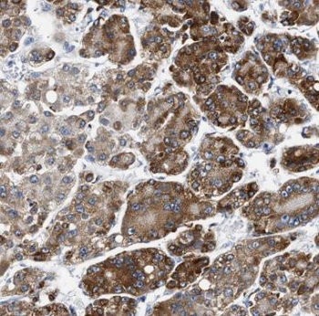 TRPT1 Antibody