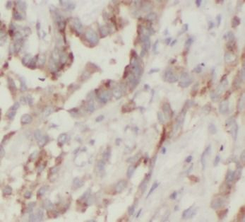 TSG101 Rabbit Polyclonal Antibody