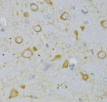 TSHR Rabbit Polyclonal Antibody