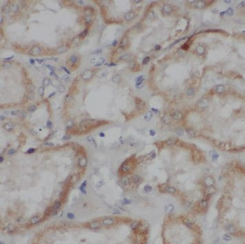TSLP Antibody