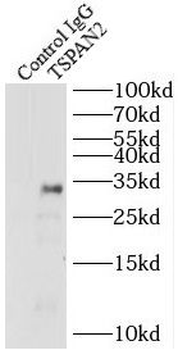 TSPAN2 Rabbit Polyclonal Antibody