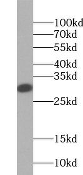 TSPAN6 Antibody