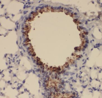 TSSC4 Rabbit Polyclonal Antibody