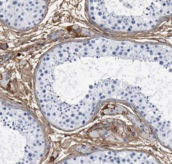 TTC32 Rabbit Polyclonal Antibody