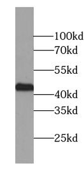 TTF1 Mouse Monoclonal Antibody