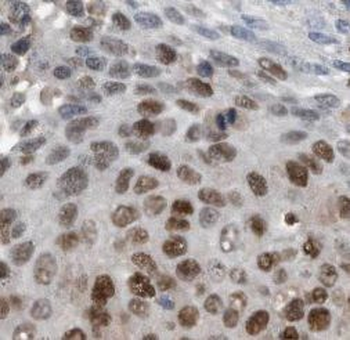 TTF1 Mouse Monoclonal Antibody