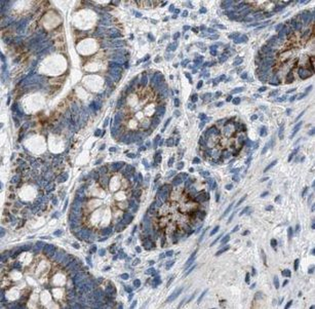 TUBGCP4 Rabbit Polyclonal Antibody