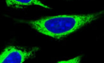 TXNDC16 Rabbit Polyclonal Antibody