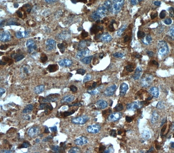 TXNDC16 Rabbit Polyclonal Antibody