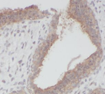 ERP44 Rabbit Polyclonal Antibody