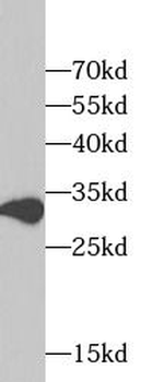 TXNL1 Rabbit Polyclonal Antibody