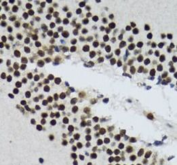 TXNL1 Rabbit Polyclonal Antibody