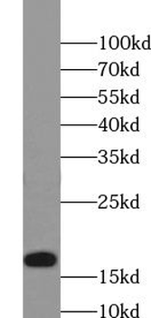 TXNL4B Antibody