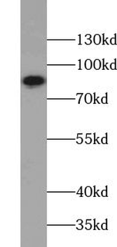 TXNRD3 Rabbit Polyclonal Antibody