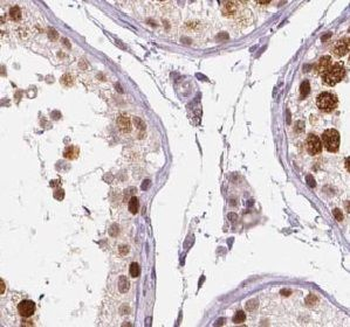 TXNRD3 Rabbit Polyclonal Antibody