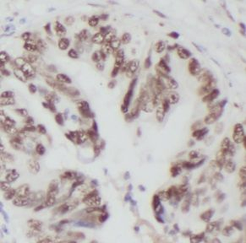 UBA1 Rabbit Polyclonal Antibody