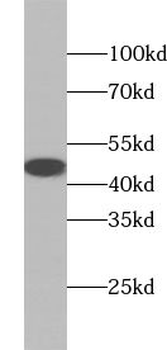 UBE2Q2 Antibody
