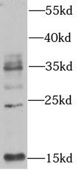 UBB Rabbit Polyclonal Antibody