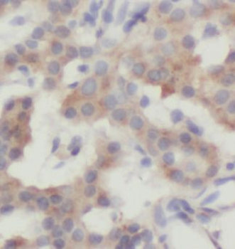 UBB Rabbit Polyclonal Antibody