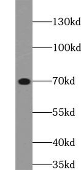 UBQLN2 Antibody