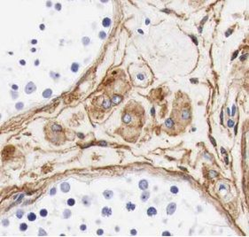 UBQLN3 Rabbit Polyclonal Antibody