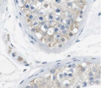 UBQLN3 Rabbit Polyclonal Antibody