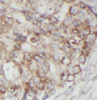 UBTD2 Rabbit Polyclonal Antibody