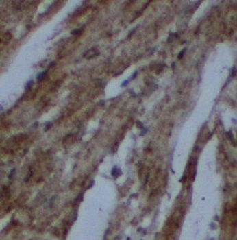 UBXN4 Rabbit Polyclonal Antibody