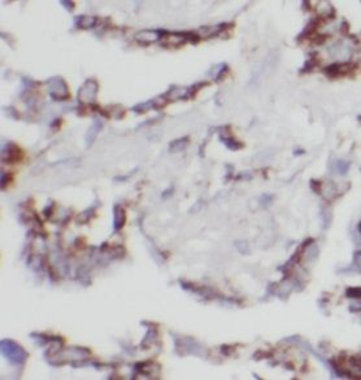 UBXN11 Rabbit Polyclonal Antibody