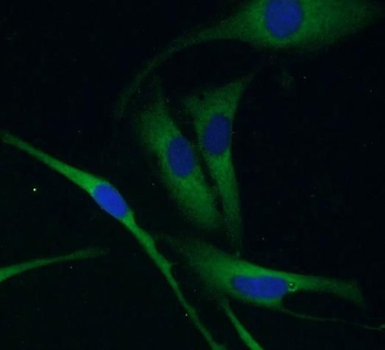 UCHL1 Mouse Monoclonal Antibody